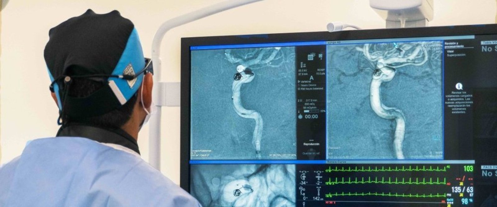 Andes Salud Puerto Montt realiza sus primeras trombectomías cerebrales para tratar el ACV