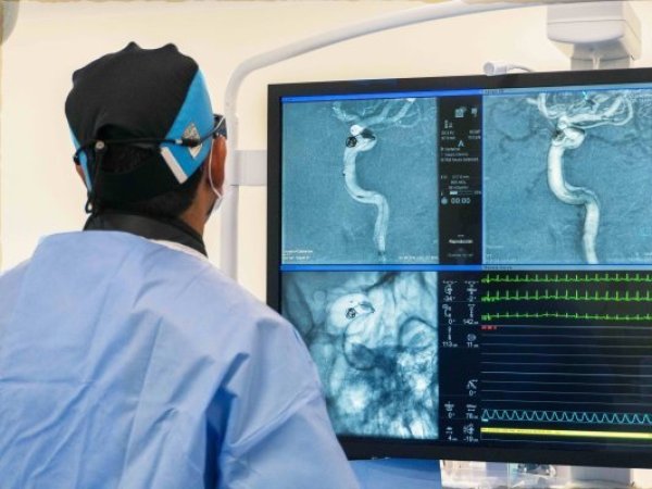 Andes Salud Puerto Montt realiza sus primeras trombectomías cerebrales para tratar el ACV